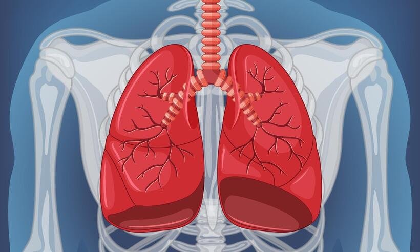 Embolia pulmonar: sintomas leves podem ser confundidos com outras doenças - rawpixel/Freepik