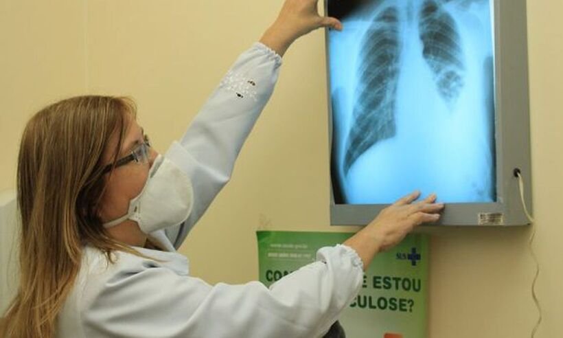 Governo cria comitê para eliminar a tuberculose - Eduardo Gomes/Fiocruz Amazônia