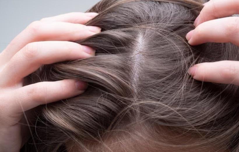 Foliculite capilar: o que é e como tratar a doença - Freepik