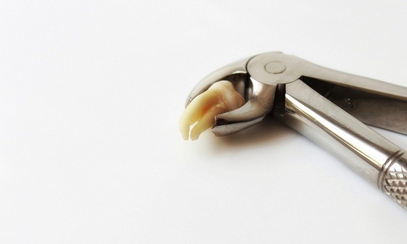 O que você precisa saber sobre o dente do siso -  Lolame/Pixabay