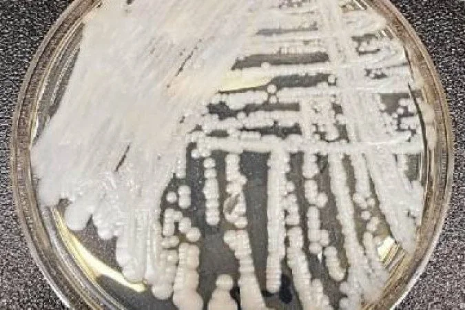 O que é Candida auris, fungo mortal que fechou hospital no Brasil  - CDC/Divulgação