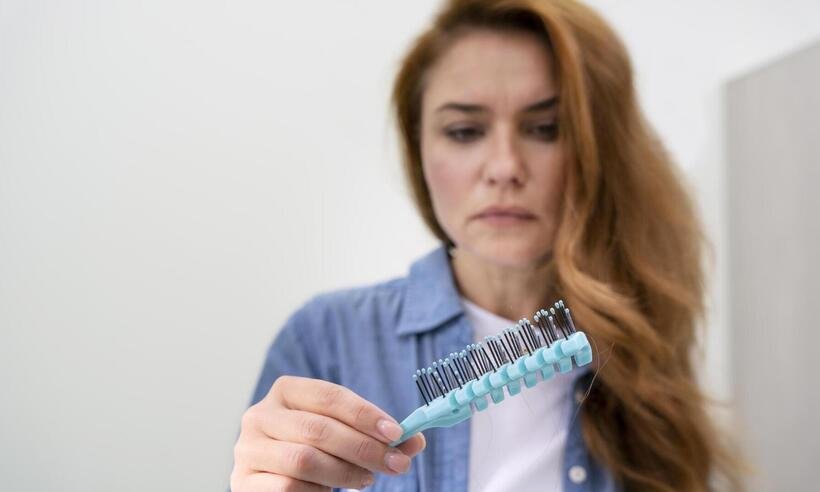 Calvície feminina: problema pode acometer até 60% das mulheres - Freepik