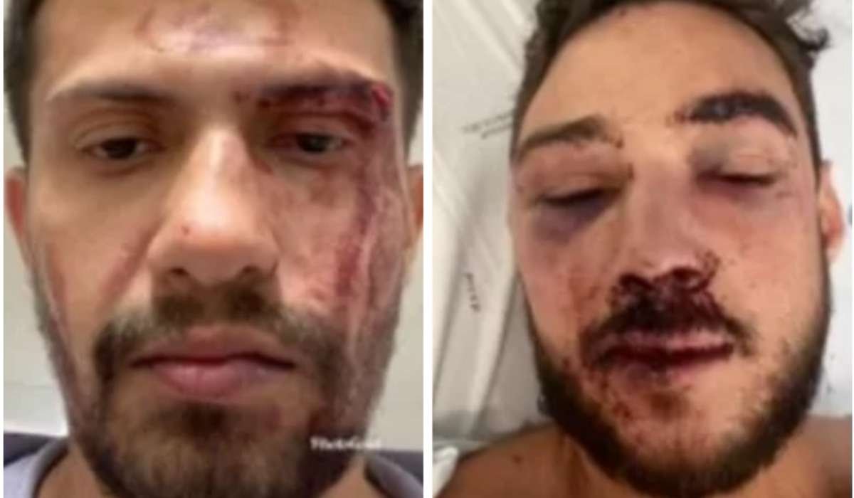 Casal gay brasileiro é espancado em boate de Portugal - Reprodução/Redes sociais