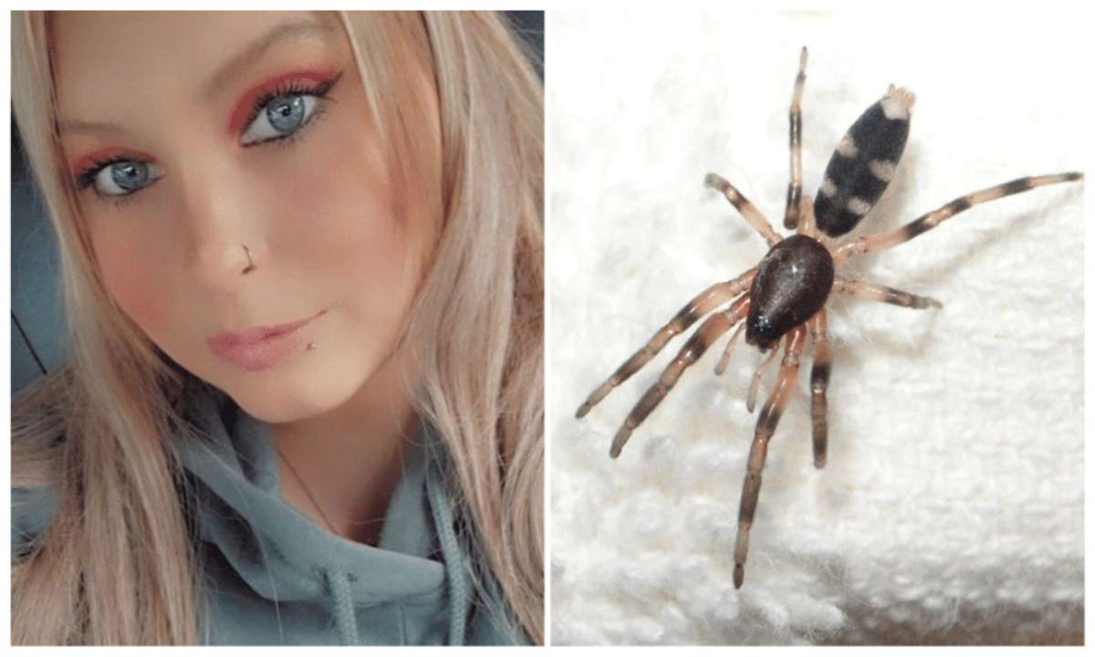 Mulher tem perna amputada após picada de aranha 'inofensiva' na Austrália - Reprodução/ Redes Sociais