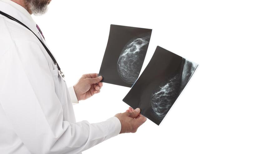  Resultados de mamografia devem ser entregues com imagens impressas - Lana_M/Divulgação