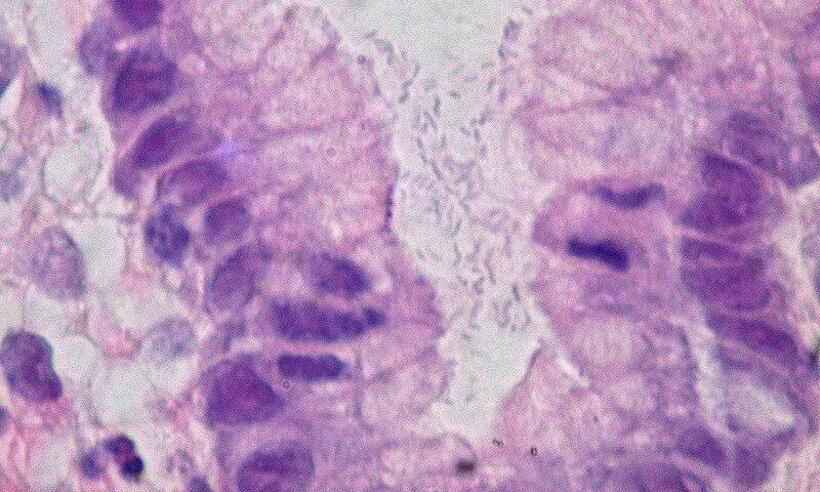 H. pylori: bactéria causa mais de 60% dos casos de câncer de estômago  - Wikimedia Commons/Ed Uthman