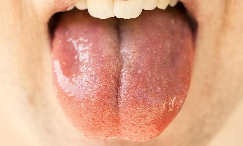 Fique de olho na sua saliva - Shaun/Pixabay