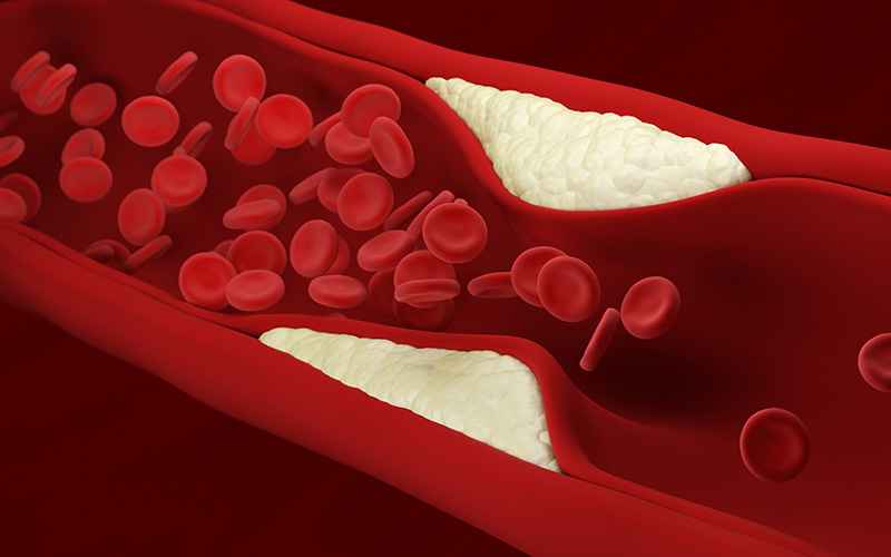 Anvisa aprova novo medicamento para controle do colesterol - Novartis/Divulgação 
