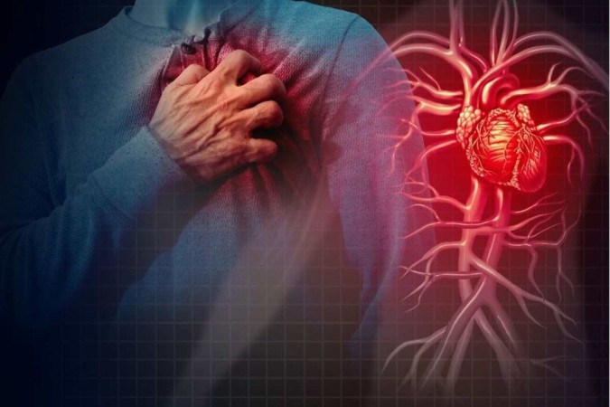 Enxaqueca é fator de risco para infarto e AVC, revela pesquisa