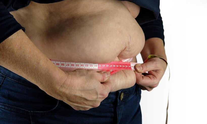  Abdominoplastia: 5 fatos que é preciso saber antes de fazer -  Bruno/Pixabay
