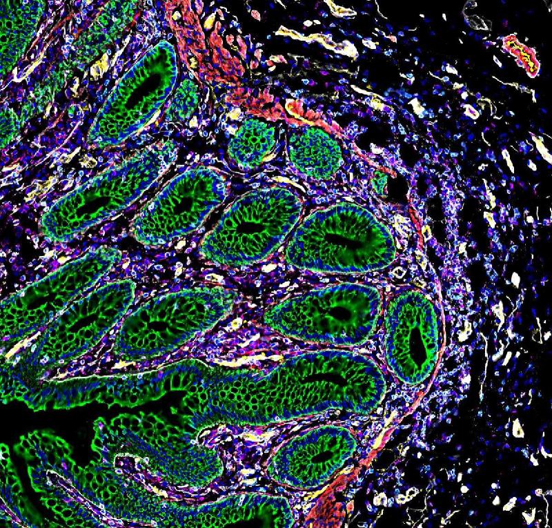 Mapeamentos de estruturas celulares ajudam a entender formação de doenças - (Stanford Medicine/Snyder lab/Nolan lab/Greenleaf lab/Divulgação)