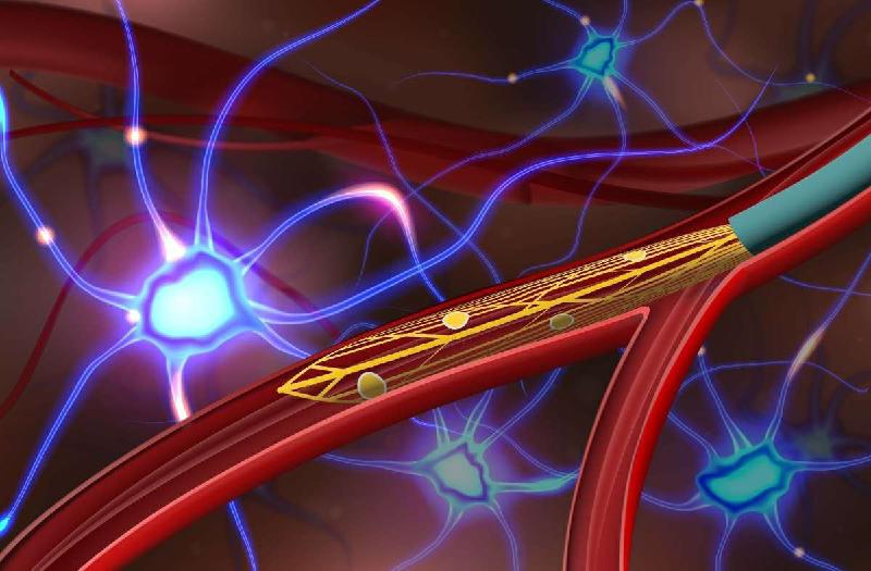 Implante neural por meio dos vasos sanguíneos para tratar doenças diversas - (Anqi Zhang, Stanford University)