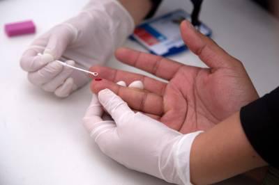 Paciente de Genebra: Nova terapia leva à cura funcional do HIV - (CLAUDIO REYES)