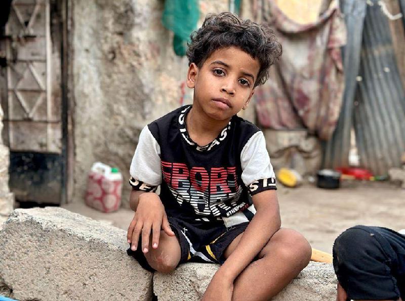 A guerra 'esquecida' que deixa milhares de crianças feridas e passando fome - GOKTAY KORALTAN/BBC