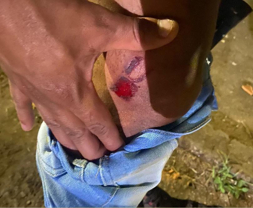 Ação da PM em distrito de Ouro Preto deixa moradores feridos - Divulgação/ arquivo pessoal
