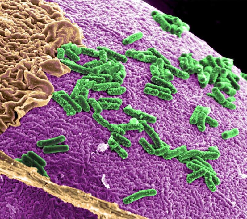 Microbiota intestinal é alvo de desinformação; entenda - (Courtesy of Pacific Northwest National Laboratory/Divulgação)