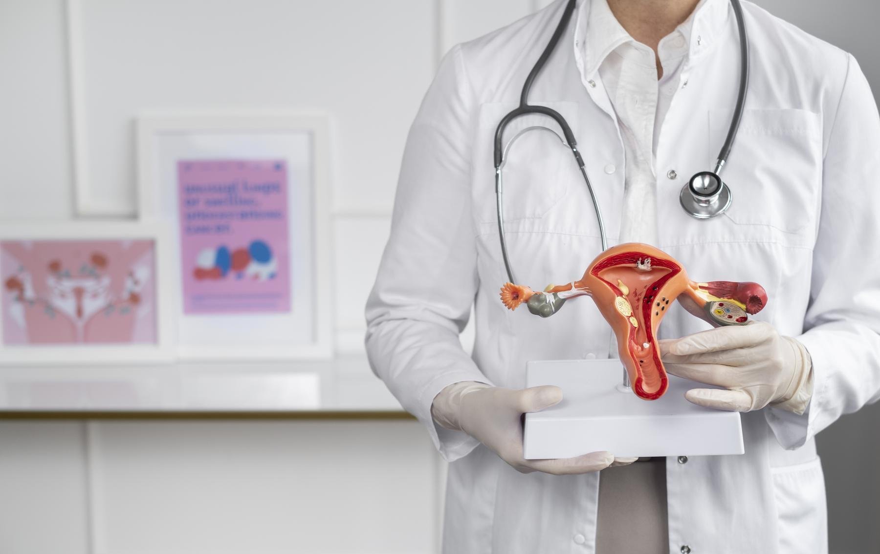  Miomas uterinos: saiba como prevenir e tratar - Freepik