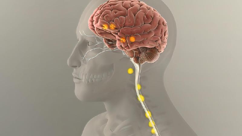 Como funciona implante para tratar depressão aplicado pela 1ª vez no Brasil - Getty Images