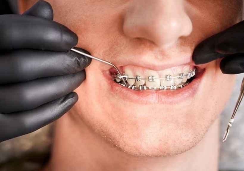 Higienização dos dentes é um momento que necessita de muita atenção para que a limpeza seja, de fato, completa -  (crédito: Freepik)