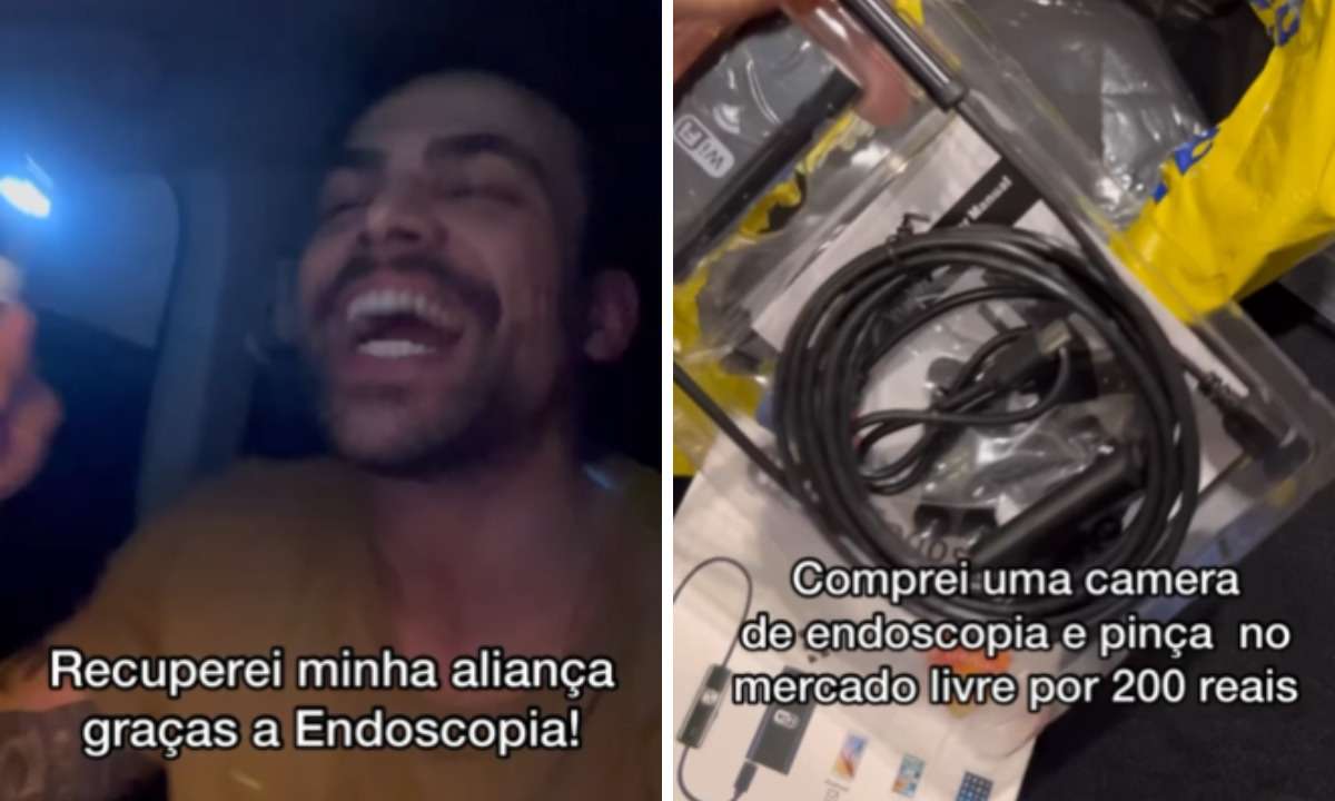 Médico faz 'endoscopia no carro' para resgatar aliança; entenda - Reprodução / instagram / @felipethereza