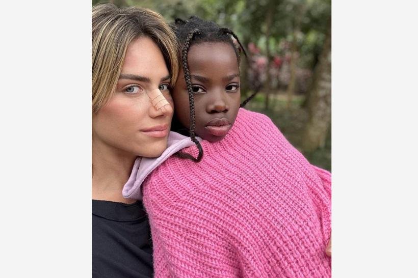 Giovanna Ewbank relata cirurgia no nariz por motivo de saúde e estética - Reprodução/Internet