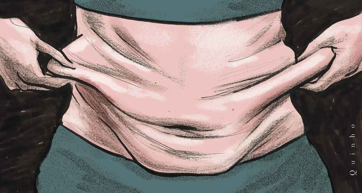 Emagrecimento acelerado com caneta pode provocar flacidez facial e corporal - QUINHO