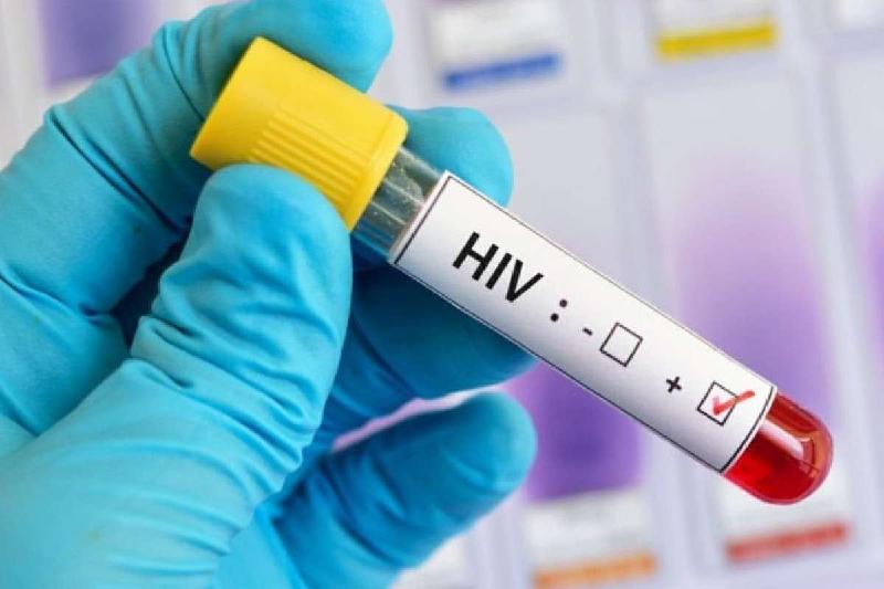 HIV: mesmo com antirretroviral, vírus não fica totalmente adormecido