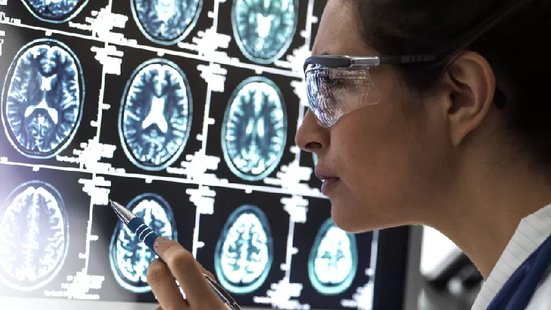 Cientistas podem ter desvendado enigma de como Alzheimer 'mata' neurônios - Getty