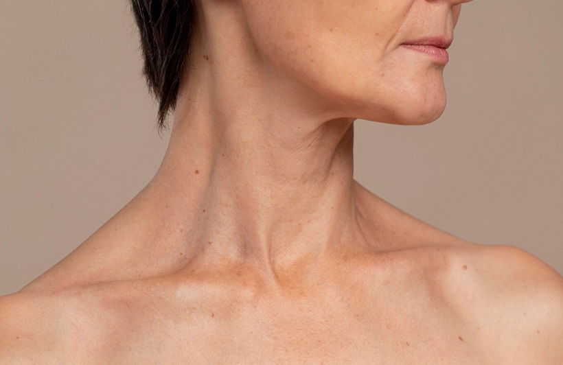 Deep Neck Lift: a técnica que rejuvenesce até os músculos do pescoço