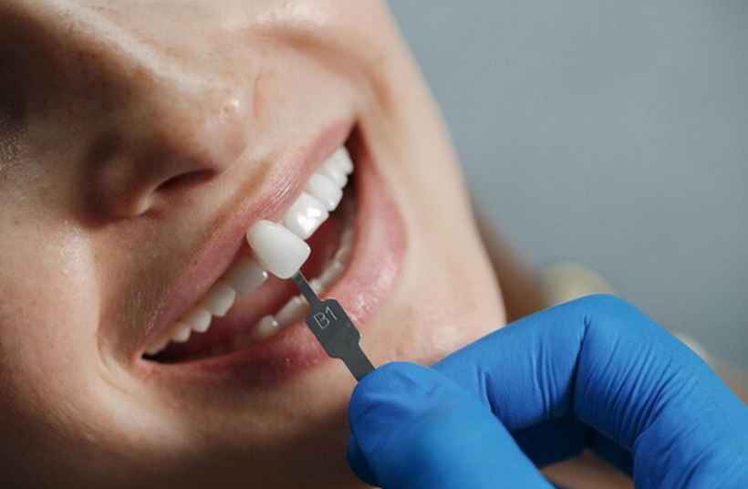 Implante dentário: profissional esclarece dúvidas sobre o assunto - Freepik